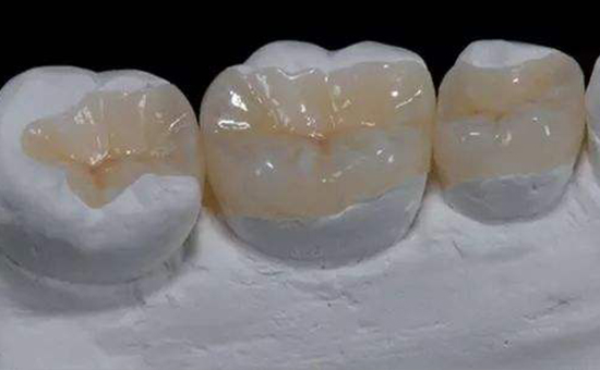 蘇州楓橋補牙多少錢